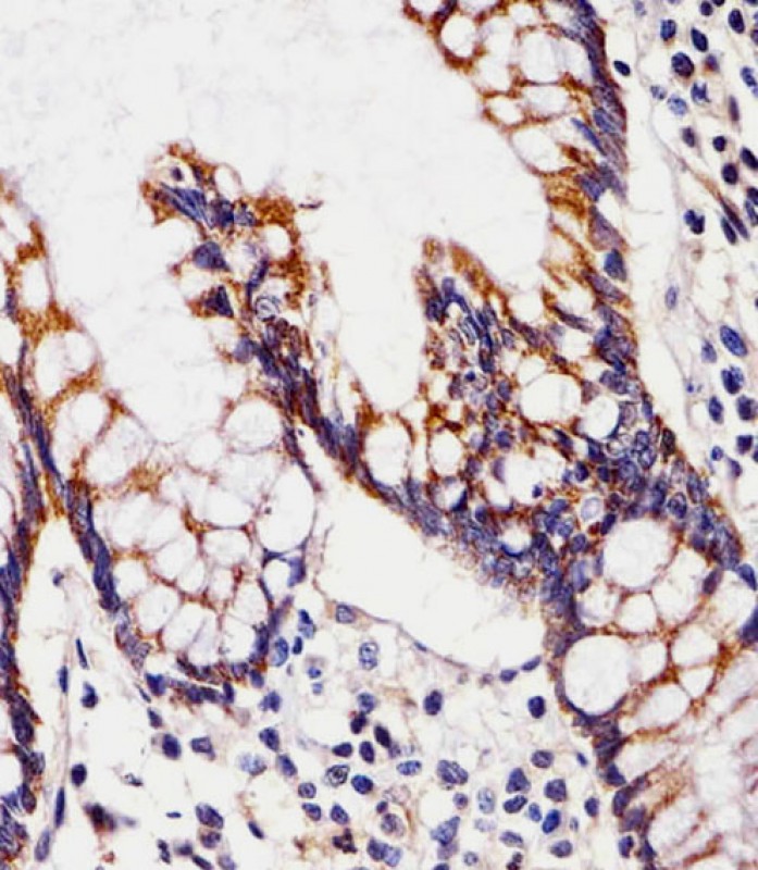 IHC-P - CHST12 Antibody (N-term) AP21028b